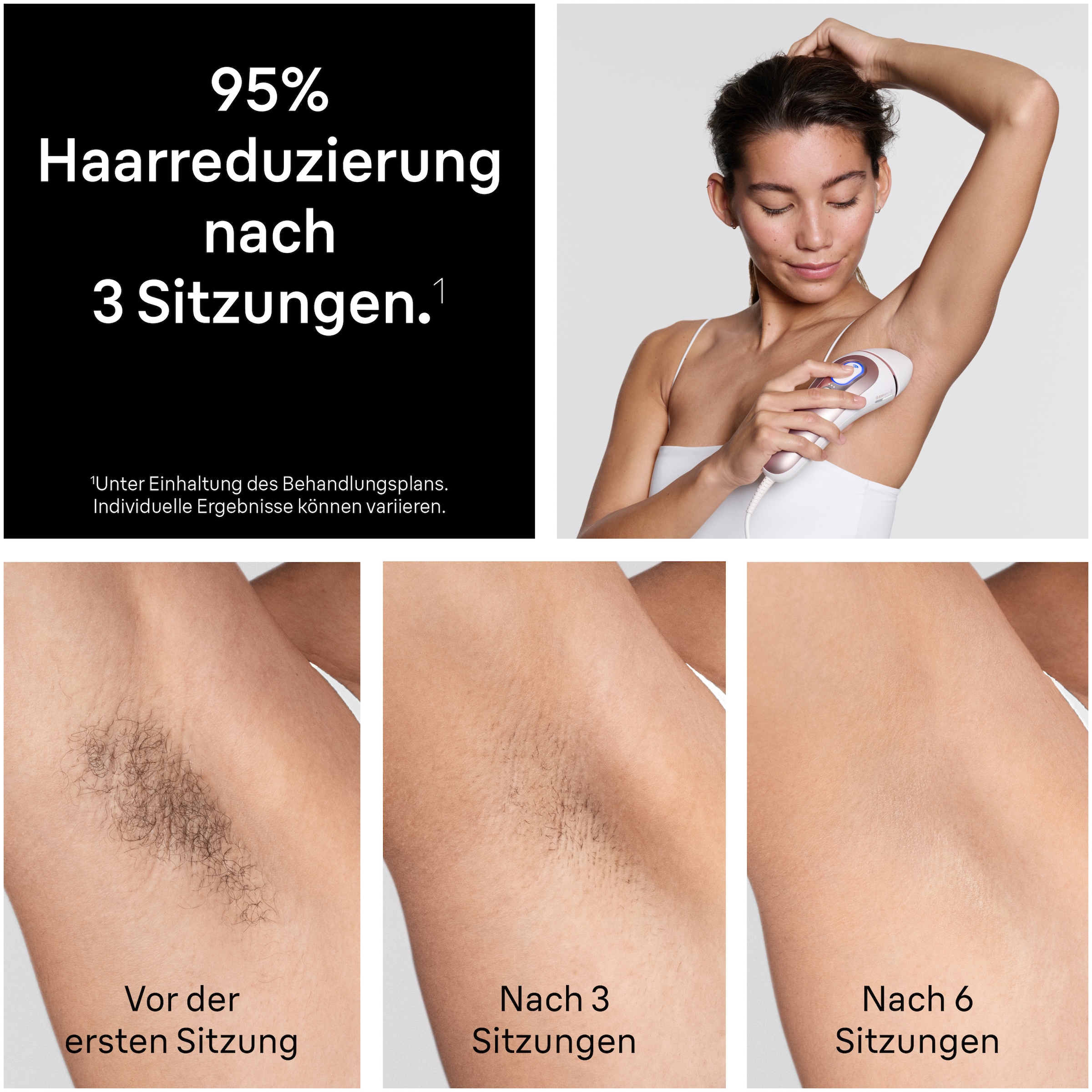 Braun IPL-Haarentferner »Skin i-expert Pro IPL PL7432« 400.000 Lichtimpulse 4 smarte Aufsätze, Tasche, Mini-Gesichtsrasierer, kostenlose App