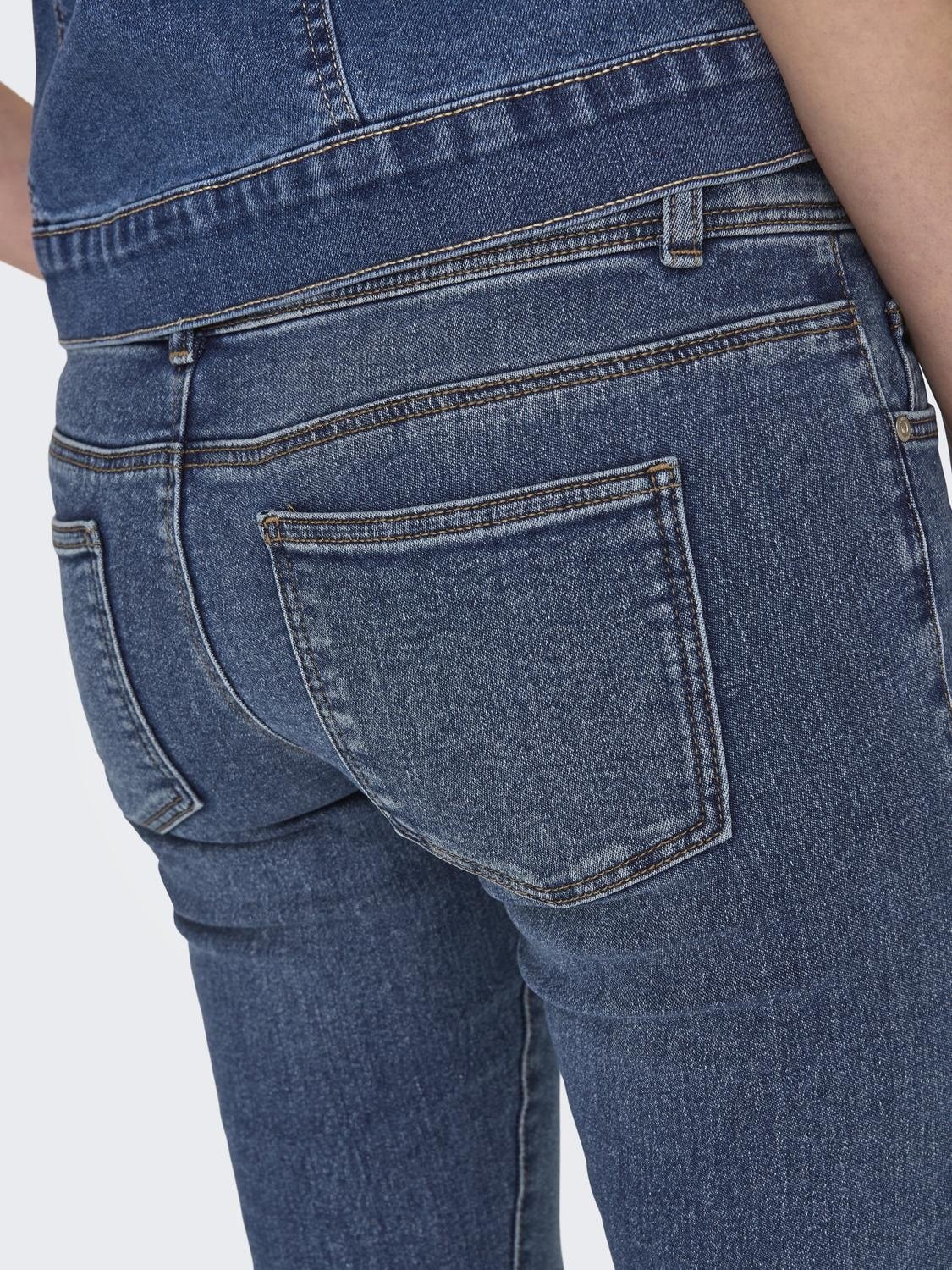 ONLY Skinny-fit-Jeans »ONLANEMONE MID SK VIS BUT DES DNM PIM«