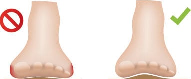 Fußgut Spreizfußbandage »Mittelfußbandage "Individual" stabilsiert und entlastet, 2 Paar«, mit Kompression gegen Überlastungserscheinungen (Spreizfuß Probleme)