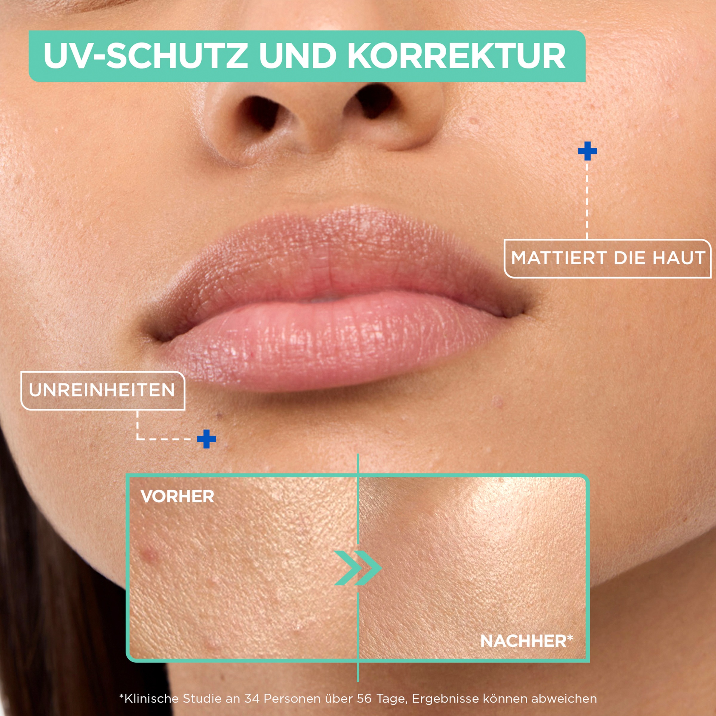 Mixa Gesichts-Reinigungsfluid »MIXA ANTI-UNREINHEITEN LSF50 + UV FLUID« mit Niacinamid