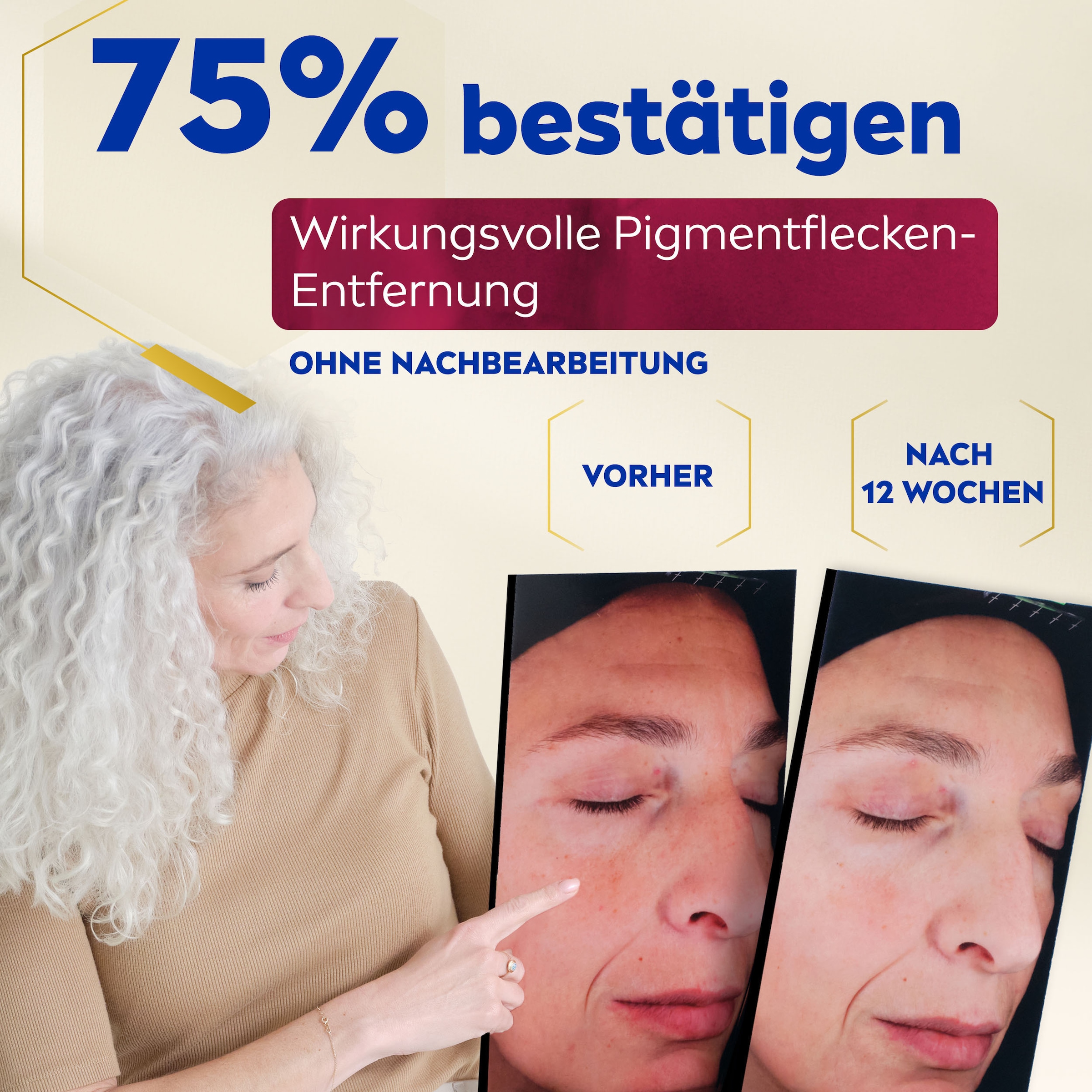 Nivea Gesichtsserum »LUMINOUS630 ANTI-PIGMENTFLECKEN Intensiv-Serum«