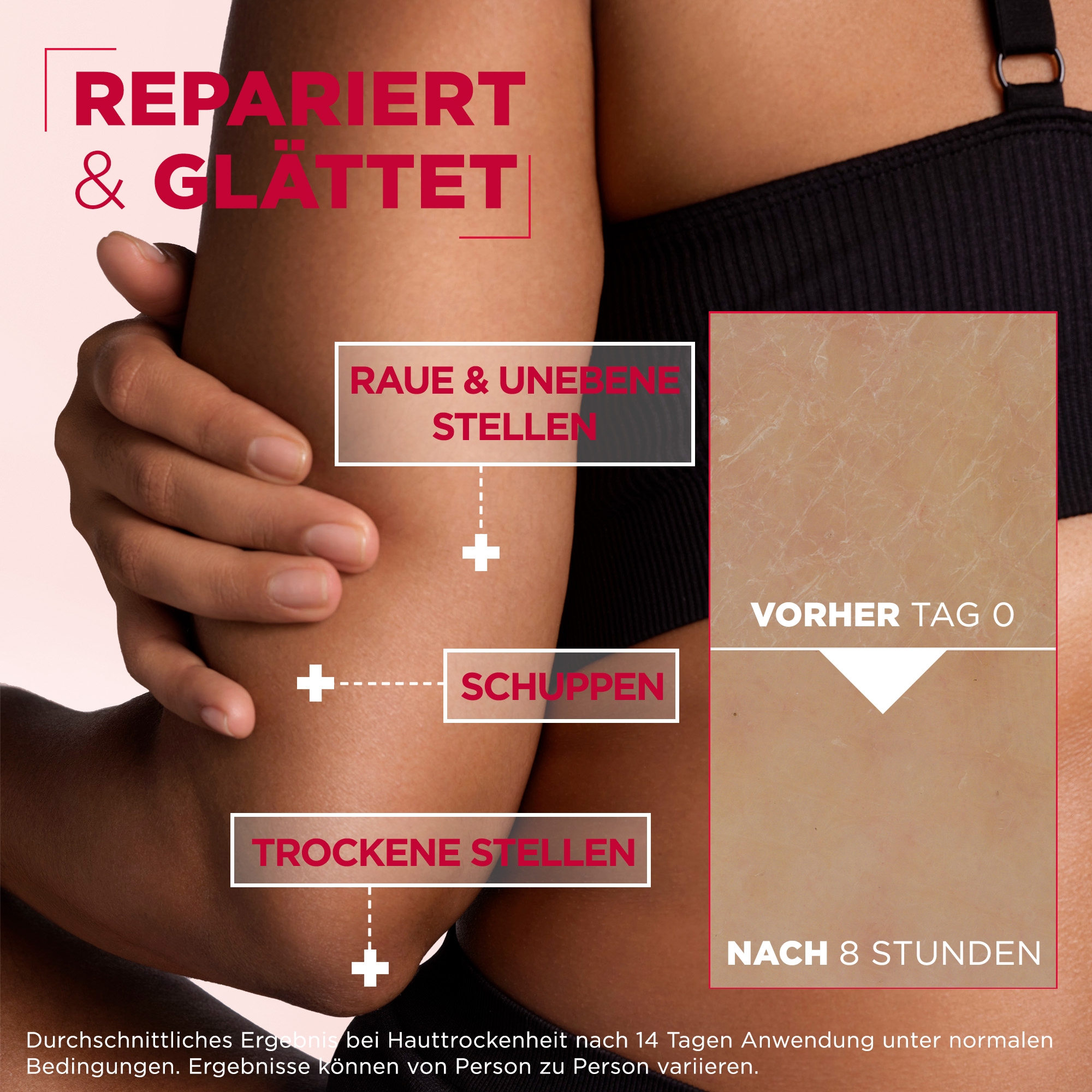 Mixa Körpercreme »MIXA UREA CICA REPAIR + HAUTERNEUERNDE CREME« gegen trockene Haut und Hautirritationen, tiefenwirksame Pflege