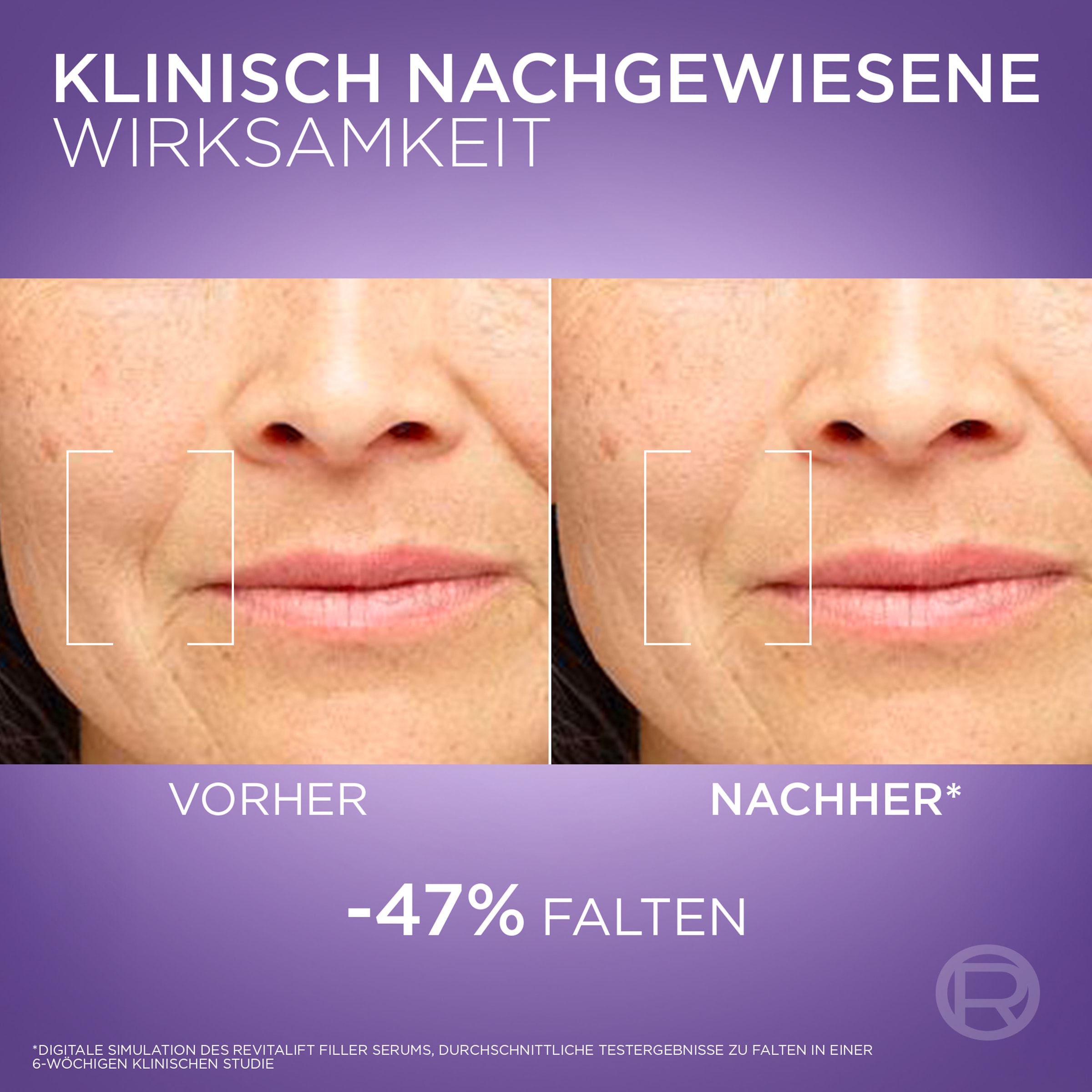 L'ORÉAL PARIS Gesichtsserum »REVITALIFT FILLER ANTI-FALTEN SERUM« mindert Falten, feutigkeitsspendend, mit Pipette