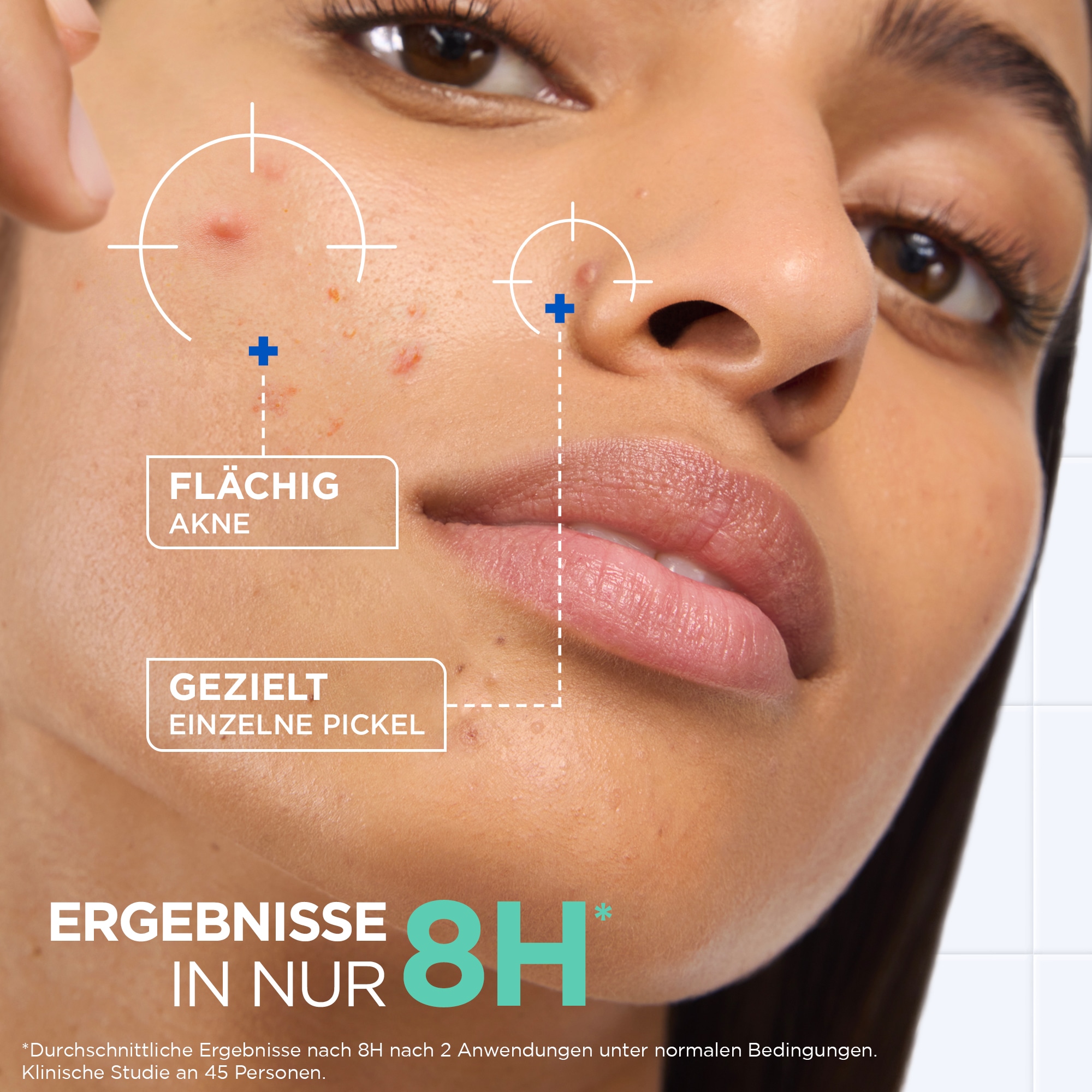 Mixa Gesichts-Reinigungscreme »MIXA KONZENTRIERTE ANTI-PICKEL PASTE« mit Niacinamid