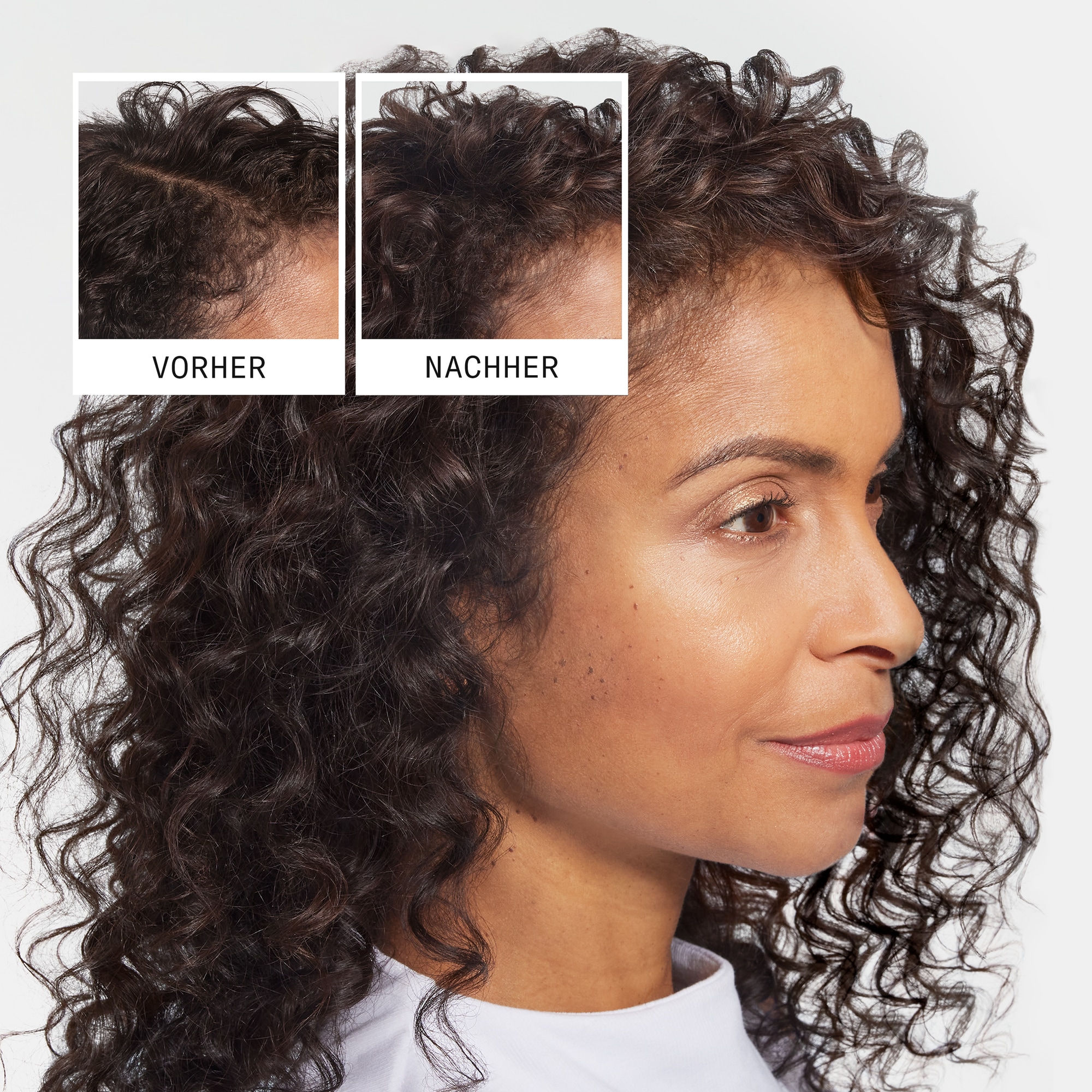 Nioxin Kopfhaut-Pflegeshampoo »Anti-Hairloss Shampoo« nährend, pflegend, gegen Haarverlust