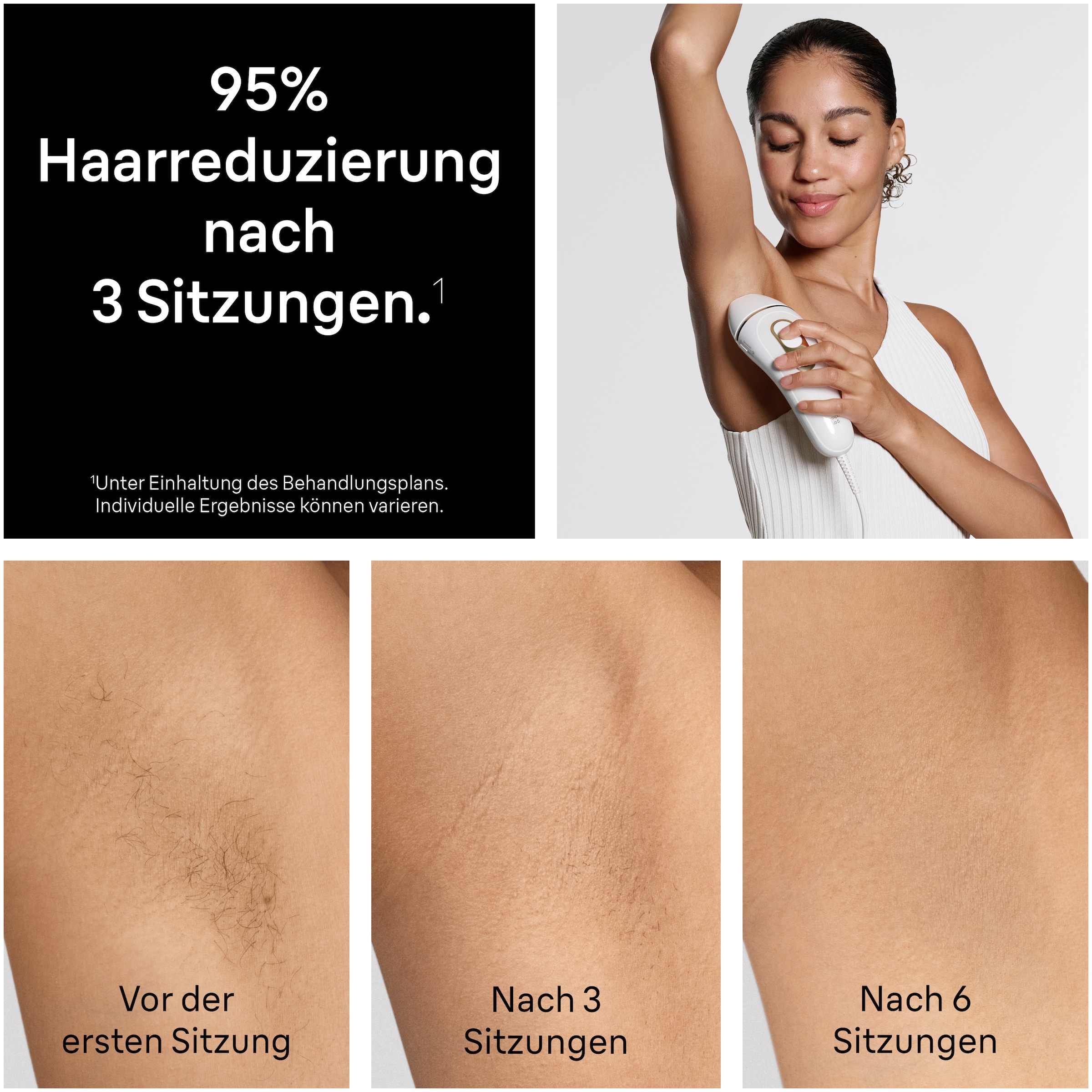 Braun IPL-Haarentferner »Silk-expert Pro IPL PL5431« 400.000 Lichtimpulse dauerhafte Haarreduktion, mit Tasche, Venus Rasierer, 4 Aufsätze