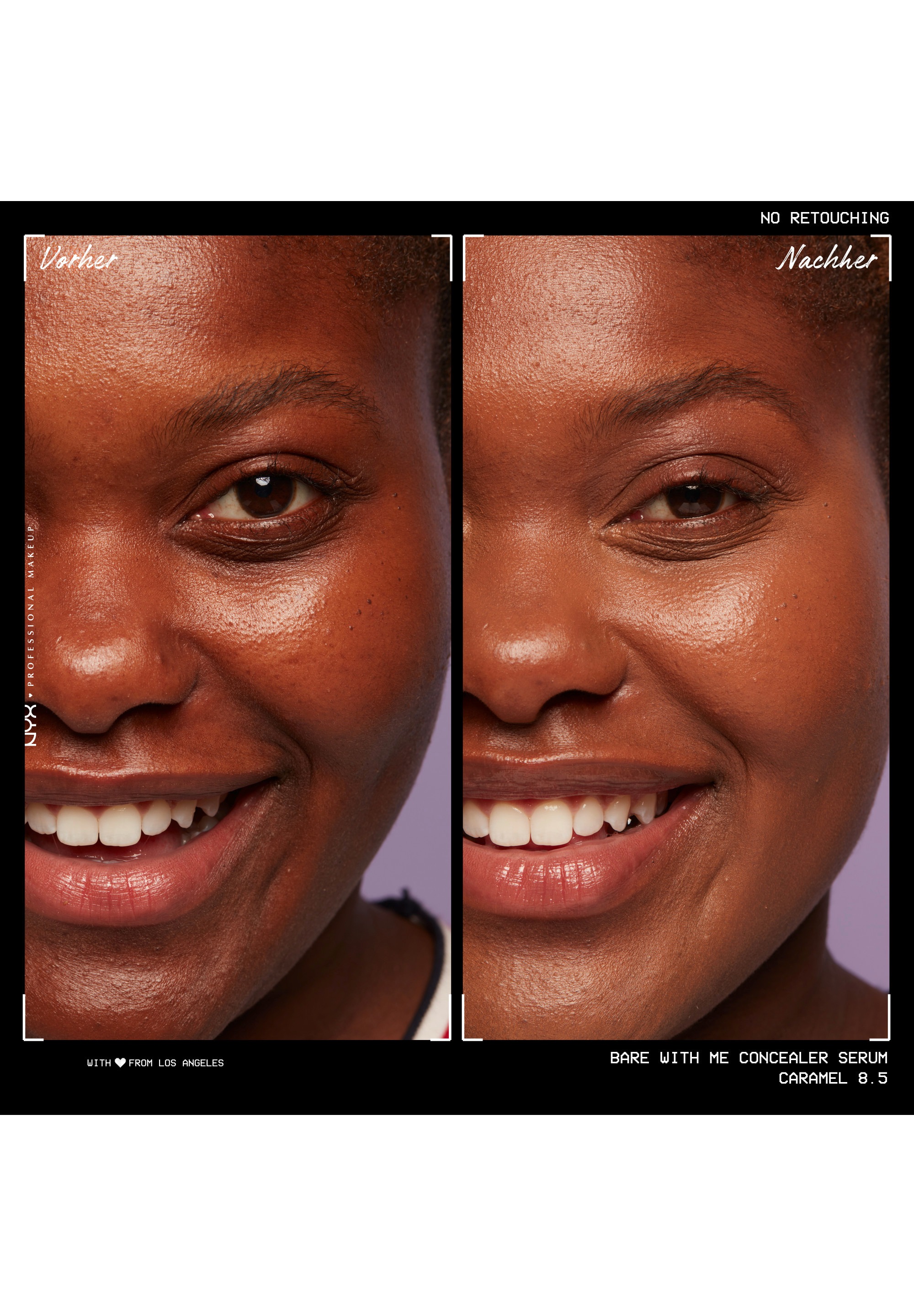 NYX PROFESSIONAL MAKEUP Concealer »Bare With Me Concealer Serum« mittlere Deckkraft, kaschiert, rote oder entzündete Hautstellen