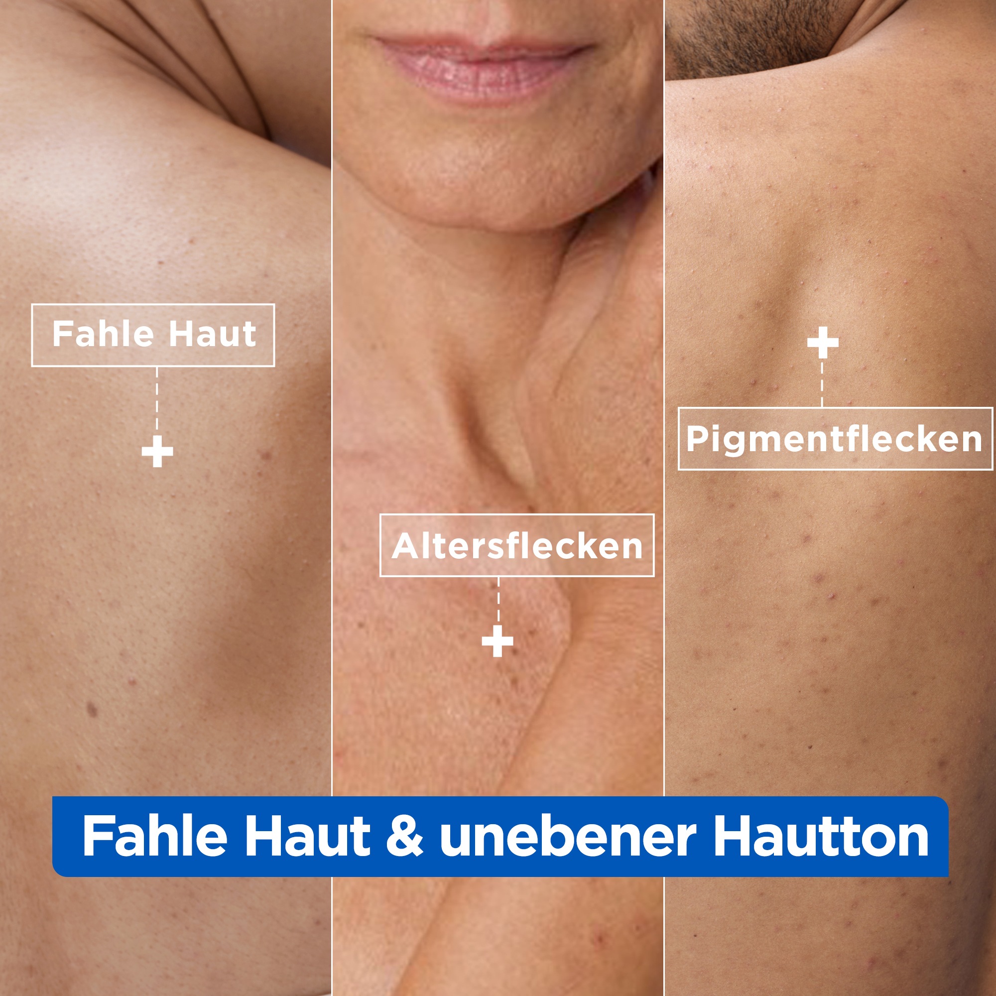 Mixa Körpermilch »Mixa Niacinamide Bright Creme«, Mildert sonnenbedingte Pigmentflecken, versorgt trockene Haut.