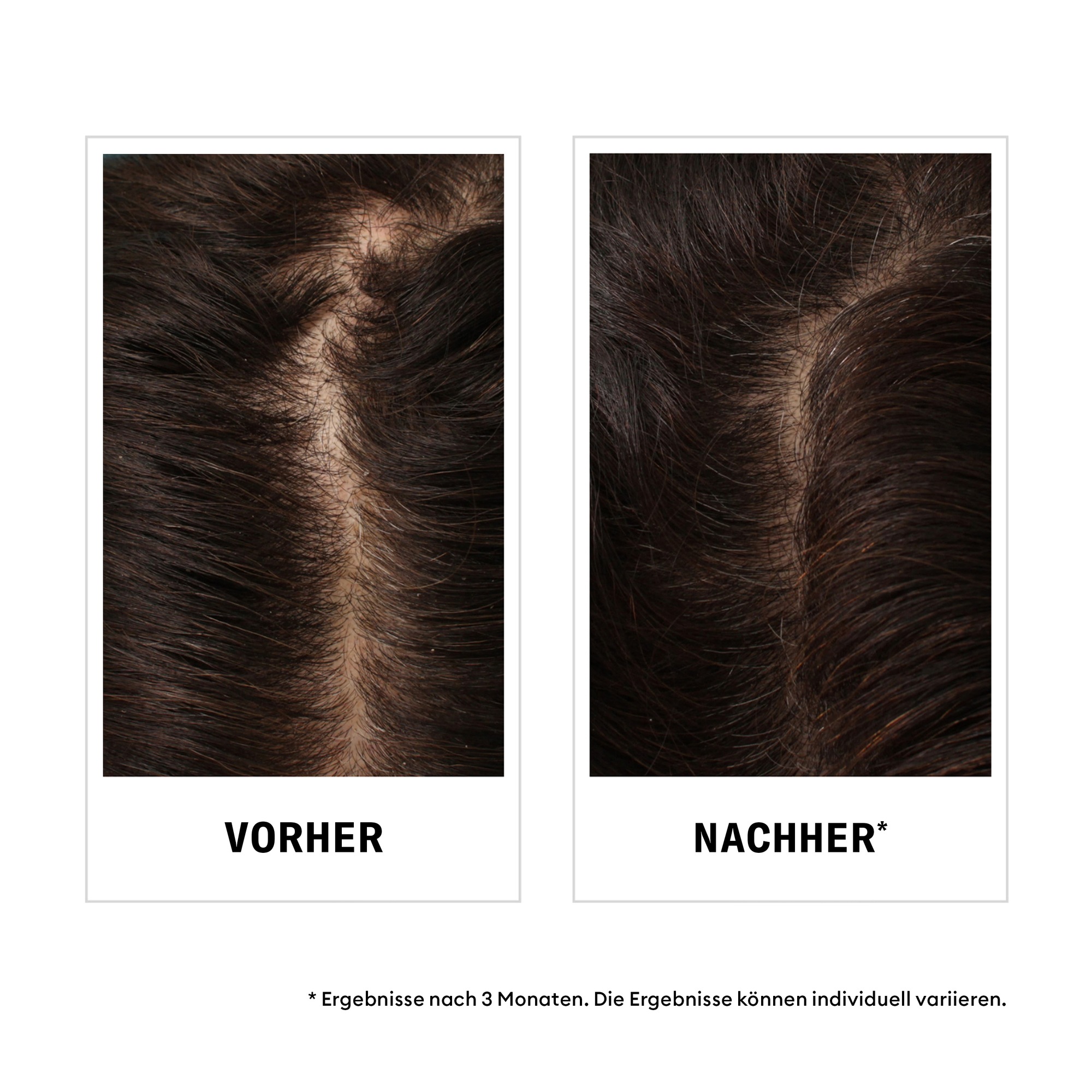 Nioxin Kopfhaut-Pflegeshampoo »NIOXIN ANTI-HAIR LOSS SHAMPOO« nährend, pflegend, gegen Haarverlust