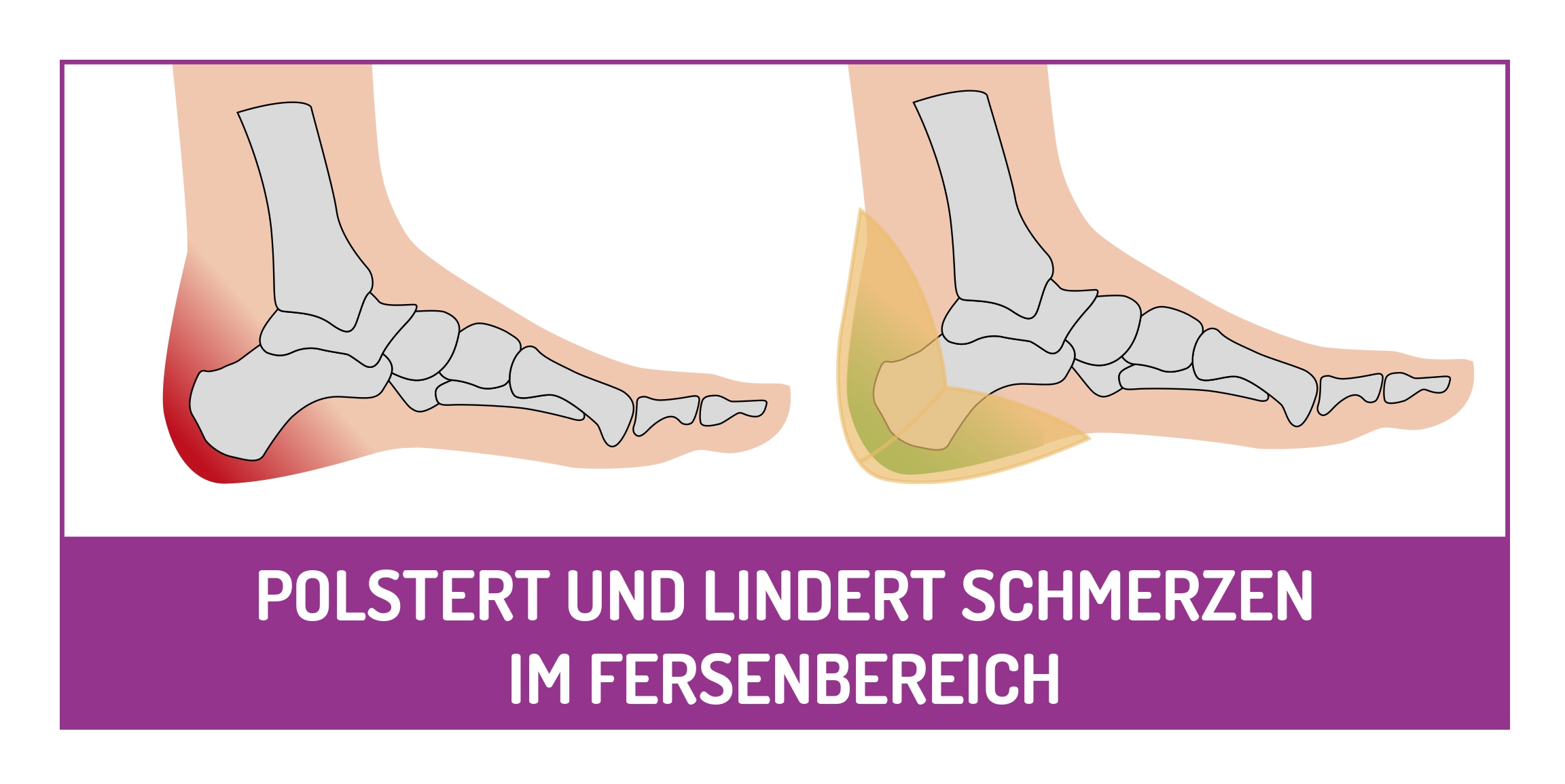 Fußgut Hallux-Bandage »"Individual" mit softem Gel-Ballenpolster, einfach anzulegen«, angenehmer Tragekomfort, individuelle Einstellmöglichkeiten
