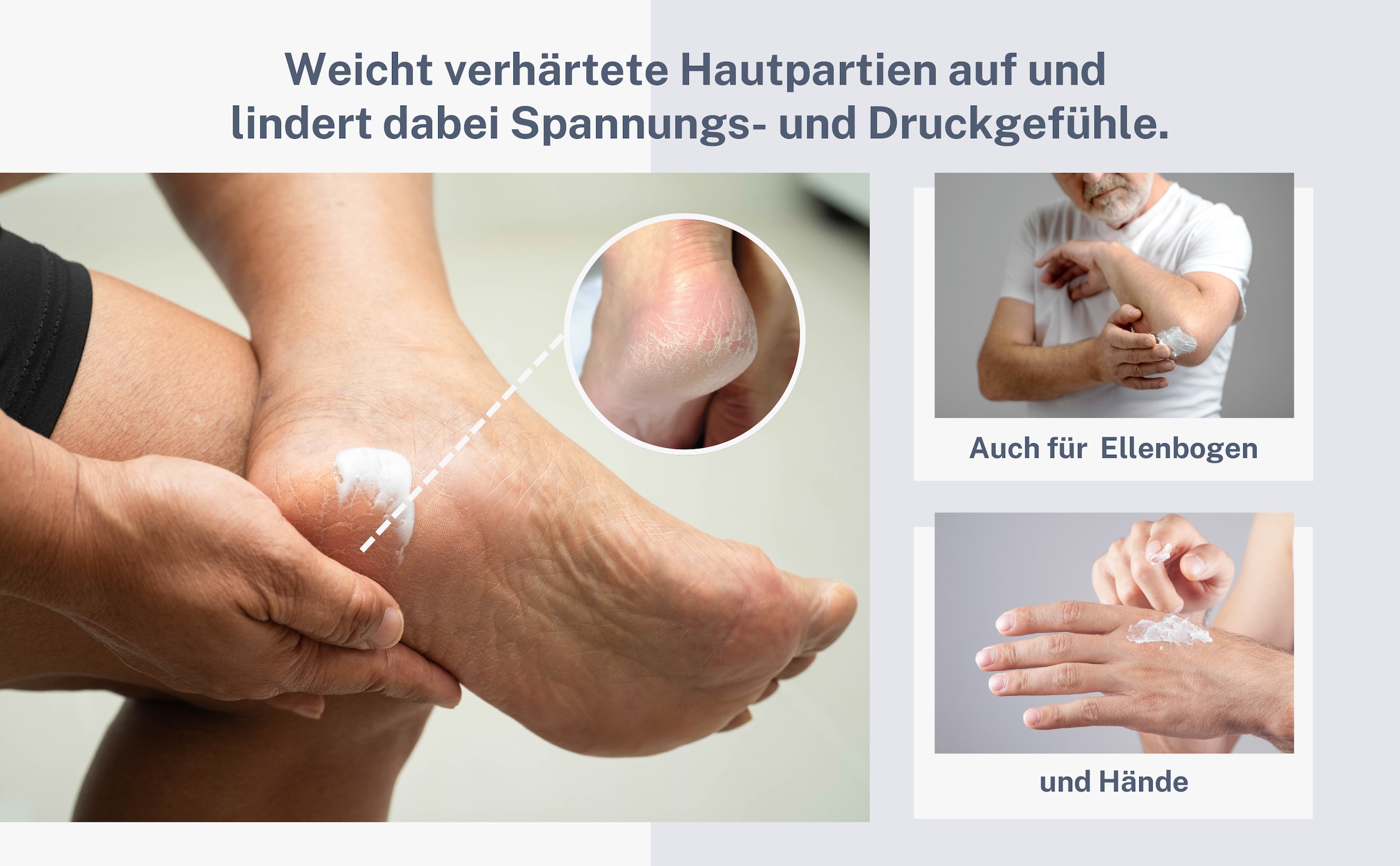 Hydas Hornhautbalsam »DermaAktiv Pflegebalsam zur Hornhautreduktion für raue Hautpartien« 75% Hornhautreduzierung in 28 Tagen, auch für Diabetikerhaut geeignet