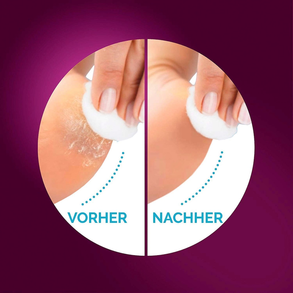 Scholl Elektrischer Hornhautentferner »Velvet Smooth«