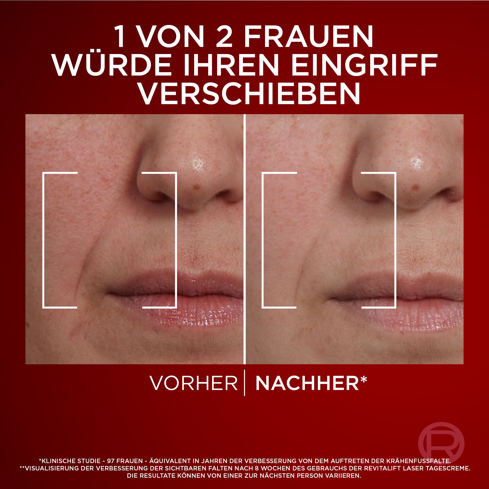 L'ORÉAL PARIS Tagescreme »REVITALIFT LASER DREIFACH-POWER ANTI-AGE TAGESPFLEGE LSF 25« mit Pro-Retinol, Hyaluronsäure und Vitamin C