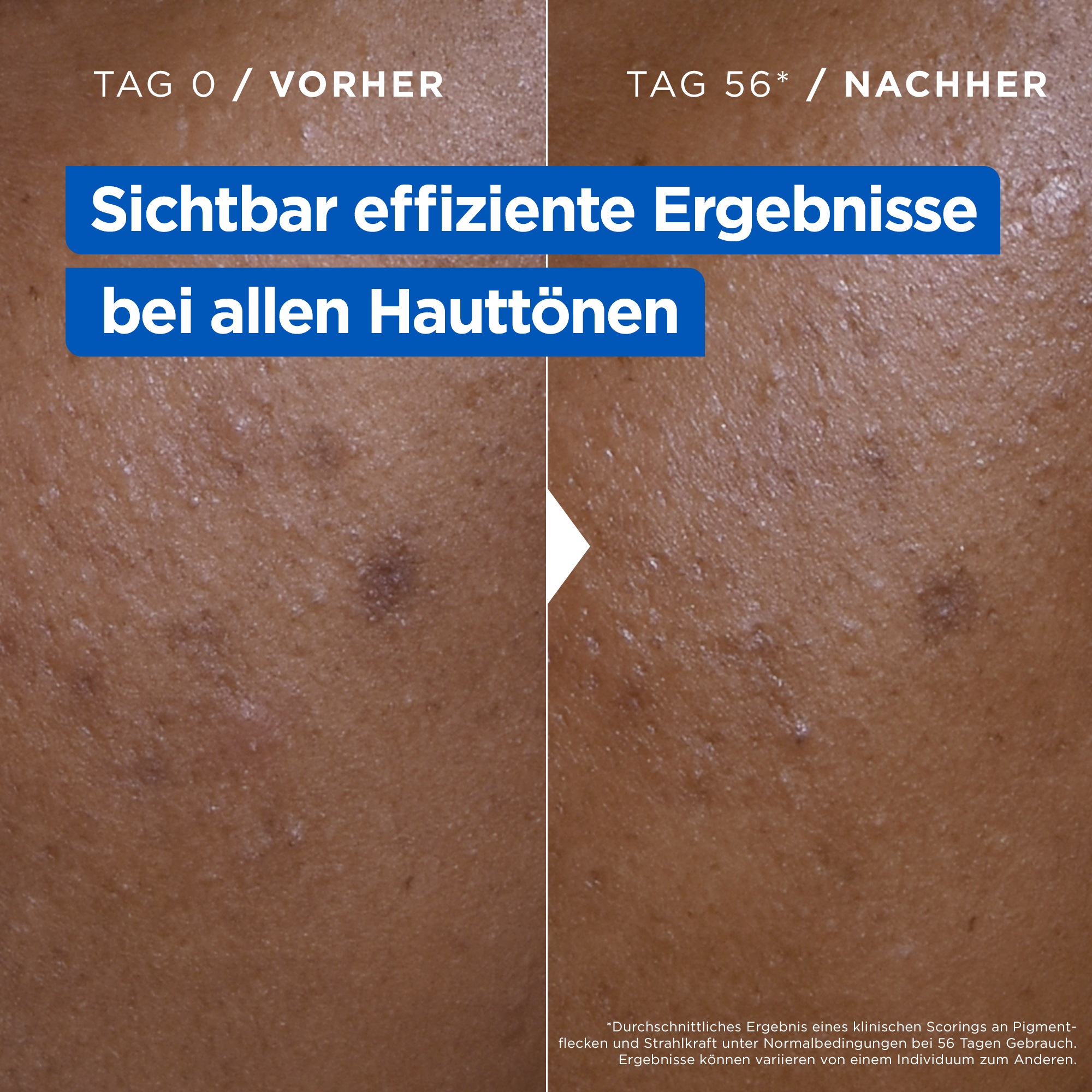 Mixa Körpermilch »Mixa Niacinamide Bright Creme«, Mildert sonnenbedingte Pigmentflecken, versorgt trockene Haut.