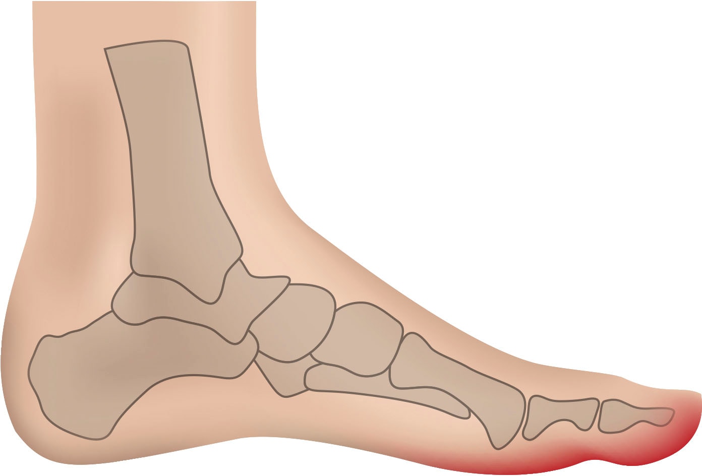 Fußgut Fußpolster »Zehenkappen "Supersoft"«, bei Verletzungen, Hallux valgus, Blasen, Hühneraugen, Ballenschmerzen