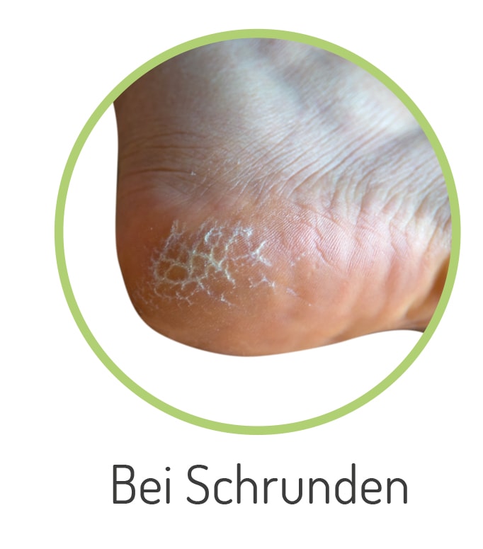 Fußgut Hallux-Bandage »"Individual" mit softem Gel-Ballenpolster, einfach anzulegen«, angenehmer Tragekomfort, individuelle Einstellmöglichkeiten